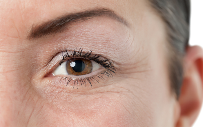 Express Yourself, Not Your Age: How Botox Can Enhance Your Eyes Without Freezing Them