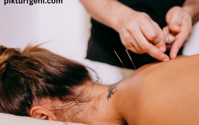 Managing Health in Sydney: Exploring the Healing Wonders of Acupuncture